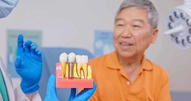 Dental Implant Benefits: Why They’re Worth the Investment
